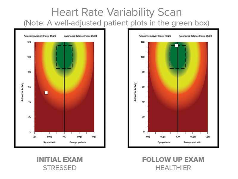 Heart Rate Variability and Trauma Integration